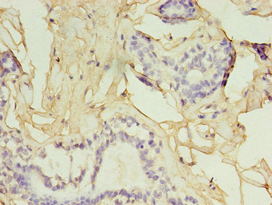 GGPS1 Antibody