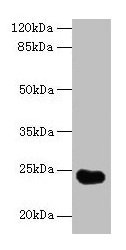 GGTLC2 Antibody