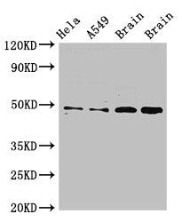 GJA8 Antibody