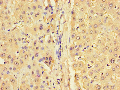 GJB1 Antibody