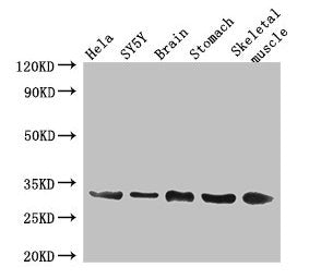 GJB3 Antibody
