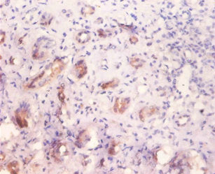 GLA Antibody