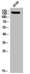 IGF1R Antibody