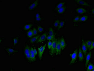 GLIPR1 Antibody
