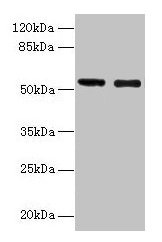 GLP1R Antibody