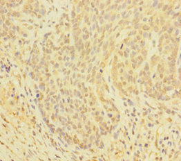 GLRX Antibody