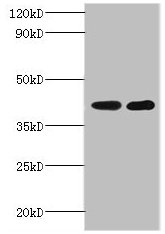 GLT8D2 Antibody