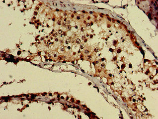 GNAQ Antibody