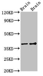 GNB1 Antibody