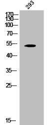 Phospho-KRT8 (S432) Antibody