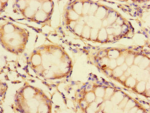 GOLPH3L Antibody