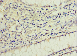 GOSR1 Antibody
