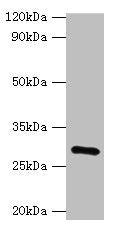 GOSR1 Antibody