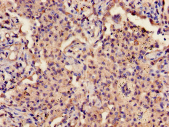 GP9 Antibody