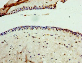 GPD1 Antibody