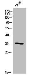OR5B12 Antibody