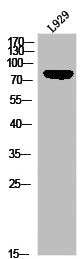 Phospho-LIPE (S855) Antibody