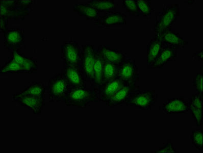GPS2 Antibody