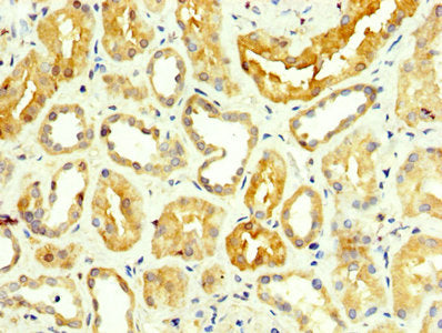 GPT Antibody
