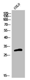 OR5H15 Antibody