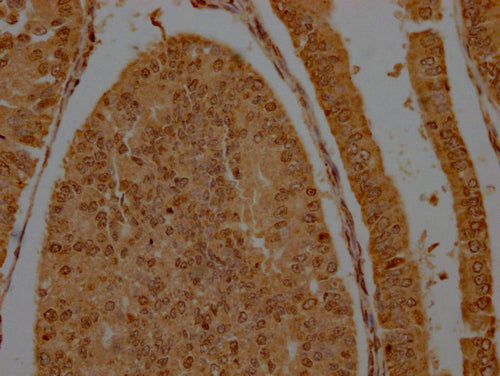 GRAP2 Antibody