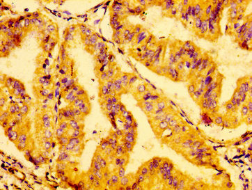 GRB14 Antibody