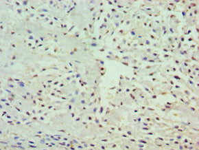 GRB7 Antibody