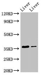 GRHPR Antibody