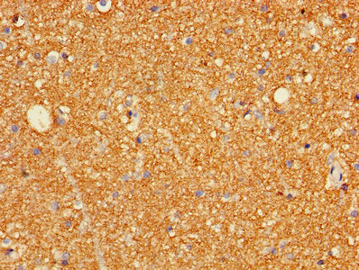 GRIA3 Antibody