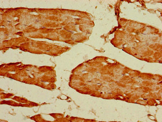 GRIN2C Antibody