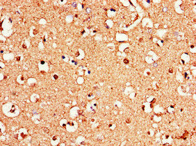 GRM1 Antibody