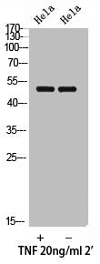 Phospho-SMAD3 (T179) Antibody