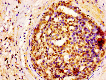 GSPT1 Antibody