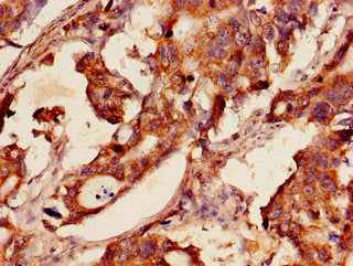 GSR Antibody