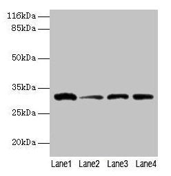 GSTK1 Antibody