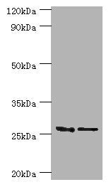 GSTM4 Antibody
