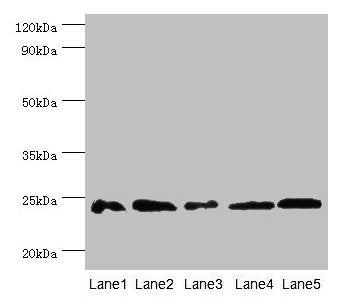 Gstp1 Antibody