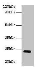 Gstp1 Antibody