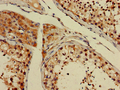 GSTT1 Antibody