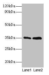 GTF2B Antibody