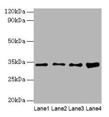 GTF2E2 Antibody