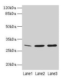 GTF2F2 Antibody