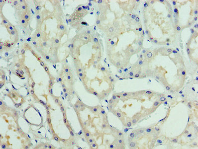 GTF2H5 Antibody