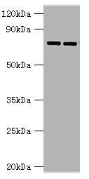 GUSB Antibody