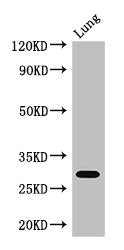 PSMB5 Antibody