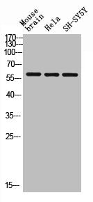 ARSE Antibody