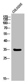 MC1R Antibody