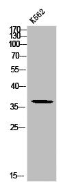 Phospho-MCL1 (S159) Antibody