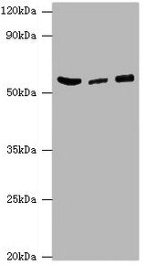HARS Antibody