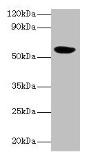 HARS2 Antibody